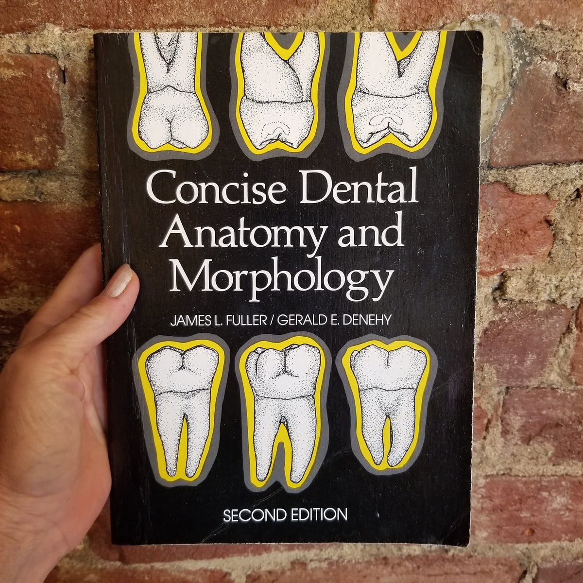 Concise Dental Anatomy and Morphology - Gerald E. Denehy 1984 Year