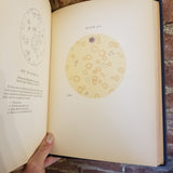 Atlas of the Blood in Children - Kenneth D. Blackfan 1948 The Commonwealth Fund vintage HB