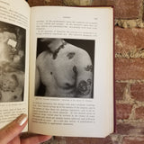 An Introduction to Dermatology - Richard Sutton 1933 The C.V. Mosby Co vintage HB