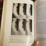 Diseases of the Esophagus - J Terracol 1958 WB Saunders Co vintage HB
